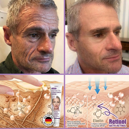 🎁 Nur noch 5 Boxen Hiskin® auf Lager! Spare heute zusätzlich 80% – starte deine tägliche Wellness-Routine, bevor dieses limitierte Angebot endet! ✅