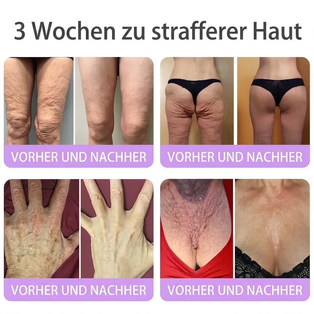 🎁 Nur noch 5 Boxen Hiskin® auf Lager! Spare heute zusätzlich 80% – starte deine tägliche Wellness-Routine, bevor dieses limitierte Angebot endet! ✅