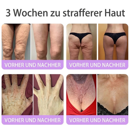 🎁 Nur noch 5 Boxen Hiskin® auf Lager! Spare heute zusätzlich 80% – starte deine tägliche Wellness-Routine, bevor dieses limitierte Angebot endet! ✅