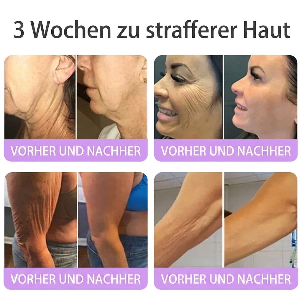 🎁 Nur noch 5 Boxen Hiskin® auf Lager! Spare heute zusätzlich 80% – starte deine tägliche Wellness-Routine, bevor dieses limitierte Angebot endet! ✅