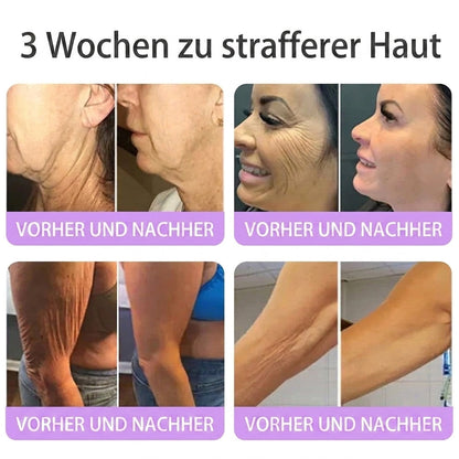 🎁 Nur noch 5 Boxen Hiskin® auf Lager! Spare heute zusätzlich 80% – starte deine tägliche Wellness-Routine, bevor dieses limitierte Angebot endet! ✅